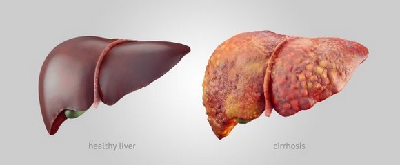 liver: good and bad